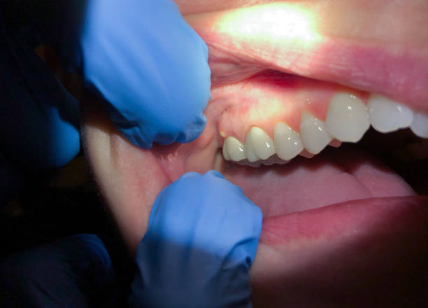 Best Pediatric Emergency Dentist in Grandview, WA